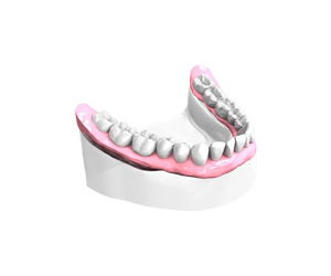 Remplacer toutes les dents absentes ou abîmées - Dentiste Haguenau